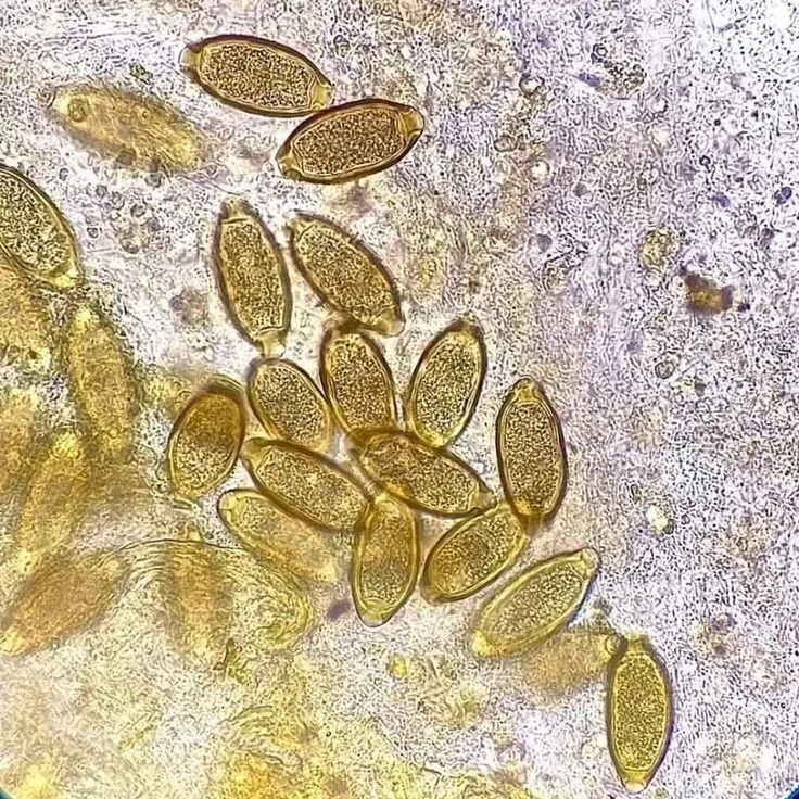Master of Medical Parasitology in Iran 