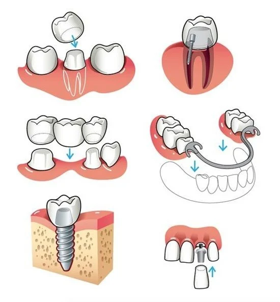  Master of Prosthodontics in Iran