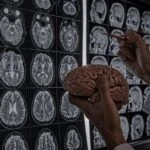 الدكتوراه البحثية في علم الأعصاب في ايران 2026-2027