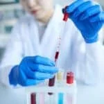 الدكتوراه البحثية في أمراض الدم المخبرية وعلوم نقل الدم في ايران 2026_2027