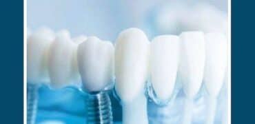 الدكتوراه البحثية في المواد الحيوية للأسنان في ايران