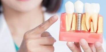 ماجستير جراحة الأسنان في أمراض اللثة في ايران